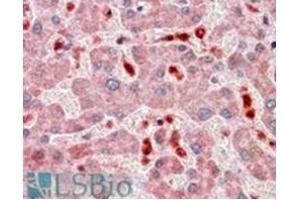 Image no. 3 for anti-PYD and CARD Domain Containing (PYCARD) (C-Term) antibody (ABIN374154) (PYCARD antibody  (C-Term))