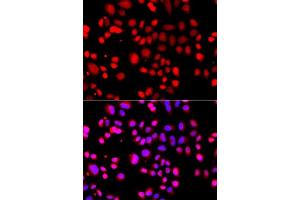 Immunofluorescence analysis of A549 cells using ASPSCR1 antibody.