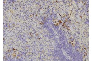 ABIN6278482 at 1/100 staining Human lymph node tissue by IHC-P. (IL32 antibody)