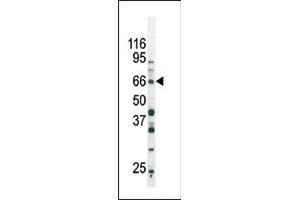 The anti-Phospho-SD3- Pab (ABIN389657 and ABIN2839640) is used in Western blot to detect Phospho-SD3- in Ramos tissue lysate (SMAD3 antibody  (pSer213))