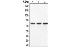 Western blot analysis of YAP1 expression in SW480 (A), HeLa (B), Caco2 (C) whole cell lysates. (YAP1 antibody  (Center))
