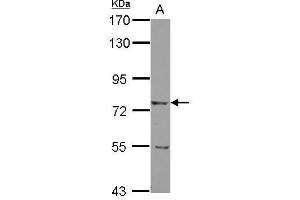 WB Image Sample (30 ug of whole cell lysate) A: U87-MG 7. (LRRN2 antibody)