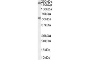 Image no. 1 for anti-Serotonin Receptor 3A (HTR3A) (Internal Region) antibody (ABIN374713) (Serotonin Receptor 3A antibody  (Internal Region))