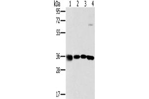 Western Blotting (WB) image for anti-Mitochondrial Ribosomal Protein L39 (MRPL39) antibody (ABIN5544584) (MRPL39 antibody)