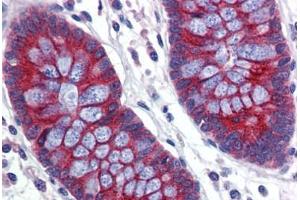 Human Colon (formalin-fixed, paraffin-embedded) stained with ABCA5 antibody ABIN462240 followed by biotinylated goat anti-rabbit IgG secondary antibody ABIN481713, alkaline phosphatase-streptavidin and chromogen. (ABCA5 antibody  (AA 1296-1345))