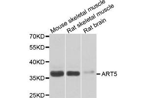 Western blot analysis of extracts of various cell lines, using ART5 antibody. (ART5 antibody)