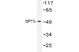 Image no. 1 for anti-Suppressor of Ty 3 Homolog (SUPT3H) antibody (ABIN272144) (SUPT3H/SPT3 antibody)