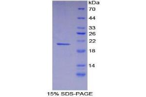 SDS-PAGE (SDS) image for Fibrillin 1 (FBN1) (AA 457-634) protein (His tag) (ABIN2121033) (Fibrillin 1 Protein (FBN1) (AA 457-634) (His tag))