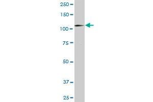 HK1 MaxPab rabbit polyclonal antibody. (Hexokinase 1 antibody  (AA 1-916))