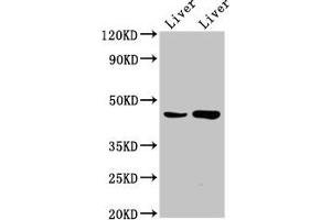 Western Blot Positive WB detected in: Rat liver tissue, Mouse liver tissue All lanes: CHKB antibody at 6. (CHKB antibody  (AA 2-99))