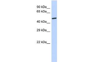 Host:  Rabbit  Target Name:  GPD2  Sample Type:  293T Whole Cell lysates  Antibody Dilution:  1. (GPD2 antibody  (N-Term))