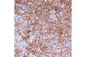 NPY antibody  (AA 1-97)
