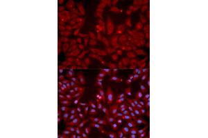 Immunofluorescence analysis of U2OS cells using GRIK2 antibody (ABIN5971002). (GRIK2 antibody)