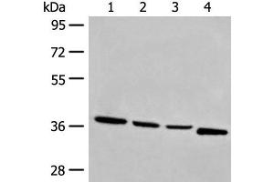 OTUD6A antibody