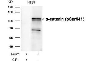 Western blot analysis of extracts from HT29 cells, treated with serum or calf intestinal phosphatase (CIP), using α-catenin (Phospho-Ser641) Antibody. (CTNNA1 antibody  (pSer641))