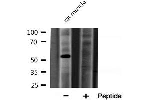 Western blot analysis of ARSA expression in Rat muscle lysate (Arylsulfatase A antibody  (Internal Region))