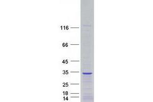 Western Blotting (WB) image for Fibroblast Growth Factor 12 (FGF12) (Transcript Variant 1) protein (Myc-DYKDDDDK Tag) (ABIN2721056)