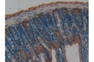 DAB staining on IHC-P; Samples: Rat Intestine Tissue (TFPI antibody  (AA 29-302))