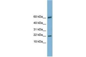 Image no. 1 for anti-Lectin, Galactoside-Binding, Soluble, 14 (LGALS14) (N-Term) antibody (ABIN6743108) (LGALS14 antibody  (N-Term))