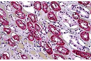 Human Kidney, Tubules: Formalin-Fixed, Paraffin-Embedded (FFPE) (DHX9 antibody  (AA 1-91))