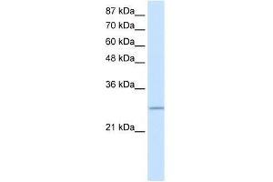 Transfected 293T; WB Suggested Anti-C20ORF20 Antibody Titration: 0. (MRGBP antibody  (Middle Region))
