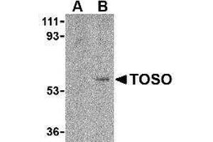 Western Blotting (WB) image for anti-Fas Apoptotic Inhibitory Molecule 3 (FAIM3) (C-Term) antibody (ABIN2476897) (FAIM3 antibody  (C-Term))