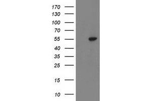 HEK293T cells were transfected with the pCMV6-ENTRY control (Left lane) or pCMV6-ENTRY ATP6V1B1 (Right lane) cDNA for 48 hrs and lysed. (ATP6V1B1 antibody)