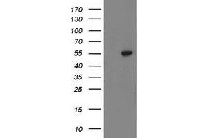 HEK293T cells were transfected with the pCMV6-ENTRY control (Left lane) or pCMV6-ENTRY ATP6V1B1 (Right lane) cDNA for 48 hrs and lysed. (ATP6V1B1 antibody)