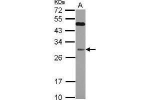 WB Image Sample (30 ug of whole cell lysate) A: Jurkat 12% SDS PAGE antibody diluted at 1:1000 (QDPR antibody)