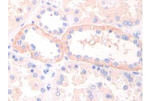 DAB staining on IHC-P; Samples: Human Kidney Tissue (LIFR antibody  (AA 692-833))