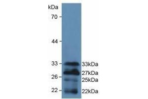 Detection of Recombinant FOXO1, Mouse using Polyclonal Antibody to Forkhead Box Protein O1 (FOXO1) (FOXO1 antibody  (AA 222-469))
