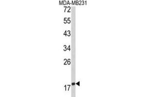 Western Blotting (WB) image for anti-CD28 (CD28) antibody (ABIN5022870)
