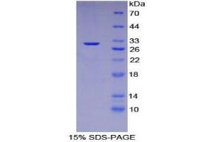 SDS-PAGE (SDS) image for Desmin (DES) (AA 117-348) protein (His tag) (ABIN1877459) (Desmin Protein (DES) (AA 117-348) (His tag))