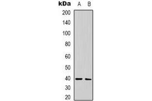 Western blot analysis of CALHM1 expression in human brain (A), rat brain (B) whole cell lysates. (CALHM1 antibody)