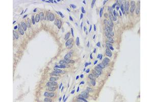 Immunohistochemistry analysis of paraffin-embedded human gallbladder using FAS Monoclonal Antibody at dilution of 1:200. (FAS antibody)