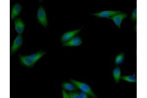 Detection of TUBb in Human MCF7 Cells using Monoclonal Antibody to Tubulin Beta (TUBb) (TUBB antibody  (AA 170-419))