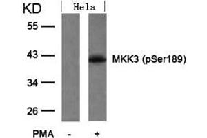 Western blot analysis of extracts from Hela cells untreated or treated with PMA using MKK3(Phospho-Ser189) Antibody. (MAP2K3 antibody  (pSer189))