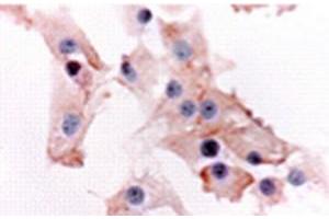 Immunocytochemical localization of PKR1 in fasciculata cells (Prokineticin Receptor 1 antibody  (N-Term))