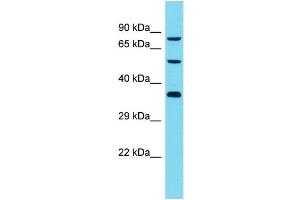 Host: Rabbit Target Name: DCAF8L2 Sample Type: Jurkat Whole Cell lysates Antibody Dilution: 1. (DCAF8L2 antibody  (C-Term))