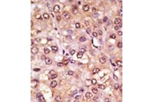 Image no. 2 for anti-Achaete-Scute Complex Homolog 1 (Drosophila) (ASCL1) (C-Term) antibody (ABIN357401) (ASCL1 antibody  (C-Term))