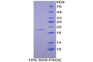 SDS-PAGE (SDS) image for Disrupted in Schizophrenia 1 (DISC1) (AA 102-261) protein (His tag) (ABIN2124651) (DISC1 Protein (AA 102-261) (His tag))