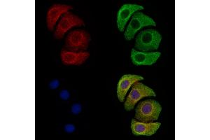 ABIN6255764 and ABIN6274056 staining Hela cells(4h of LPS treatment) by IF/ICC. (PKM2 antibody  (pTyr105))