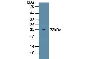 Detection of Recombinant ATP1a1 using Polyclonal Antibody to ATPase, Na+/K+ Transporting Alpha 1 Polypeptide (ATP1a1) (ATP1A1 antibody)
