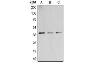 Western blot analysis of B3GALT4 expression in PC3 (A), Jurkat (B), U87MG (C) whole cell lysates.