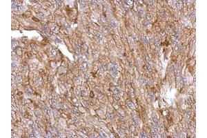 IHC-P Image Immunohistochemical analysis of paraffin-embedded U87 xenograft, using Annexin III, antibody at 1:500 dilution. (Annexin A3 antibody)