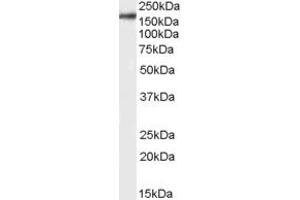 Western Blotting (WB) image for anti-CCR4-NOT Transcription Complex, Subunit 6-Like (CNOT6L) (Middle Region) antibody (ABIN2790464) (CNOT6L antibody  (Middle Region))