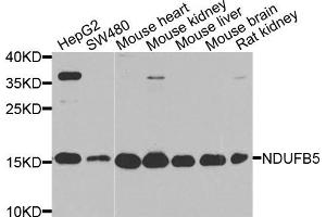 Western blot analysis of extracts of various cell lines, using NDUFB5 antibody.