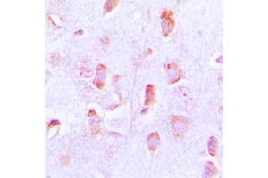 Immunohistochemical analysis of BCL2 staining in human brain formalin fixed paraffin embedded tissue section.
