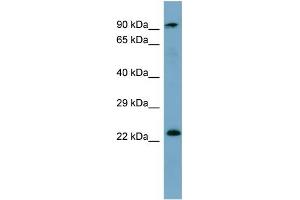 KRAS antibody used at 1 ug/ml to detect target protein.