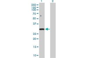 Western Blot analysis of SNRPA expression in transfected 293T cell line by SNRPA MaxPab polyclonal antibody. (SNRPA1 antibody  (AA 1-282))
